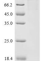 Human Carboxypeptidase N subunit 2 (CPN2) Recombinant Protein - BioCrest Sci