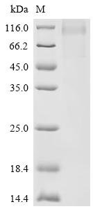 Human Carboxypeptidase N subunit 2 (CPN2) Recombinant Protein, Homo sapiens (Human), Mammalian cell, C-terminal 10xHis-tagged, 60.0 kDa, purity >≥ 90% as determined by SDS-PAGE.