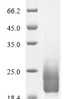 Vaccinia virus Protein OPG161 (OPG161), partial Recombinant Protein - BioCrest Sci