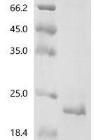 Coxiella burnetii Uncharacterized protein Recombinant Protein, N-10His/C-Myc - BioCrest Sci