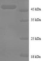 Human Tumor necrosis factor alpha-induced protein 8 (TNFAIP8) Recombinant Protein - BioCrest Sci
