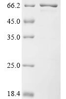 Epstein-Barr virus Small capsomere-interacting protein (SCP),Biotinylated Recombinant Protein - BioCrest Sci