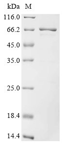 Epstein-Barr virus Small capsomere-interacting protein (SCP),Biotinylated Recombinant Protein, Epstein-Barr virus (strain B95-8) (HHV-4) (Human herpesvirus 4), E.coli, N-terminal MBP-tagged and C-terminal 6xHis-Avi-tagged, 66 kDa, purity >≥ 85% as determined by SDS-PAGE.