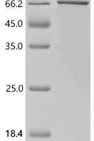 Human Otoferlin (OTOF), partial Recombinant Protein, N-His-SUMO - BioCrest Sci