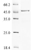 Human Heterogeneous nuclear ribonucleoproteins A2/B1 (HNRNPA2B1) Recombinant Protein, N-10His/C-Myc - BioCrest Sci