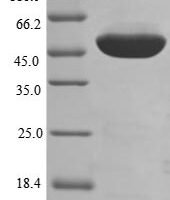 Human Elongation factor 1-alpha 1 (EEF1A1) Recombinant Protein - BioCrest Sci