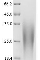 Human Palmitoyltransferase ZDHHC5 (ZDHHC5), partial Recombinant Protein - BioCrest Sci