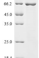 Mouse N-myc-interactor (Nmi) Recombinant Protein - BioCrest Sci