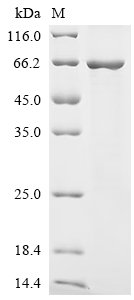 Mouse N-myc-interactor (Nmi) Recombinant Protein, Mus musculus (Mouse), E.coli, N-terminal 6xHis-GST-tagged, 66.7 kDa, purity >≥ 85% as determined by SDS-PAGE.