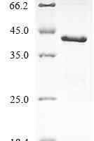 Mouse NAD (P)H dehydrogenase [quinone] 1 (Nqo1) Recombinant Protein - BioCrest Sci