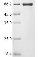 Gorilla gorilla gorilla Tyrosine-protein kinase (LCK) (C476S) Recombinant Protein - BioCrest Sci