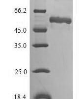 Human Asporin (ASPN) Recombinant Protein - BioCrest Sci