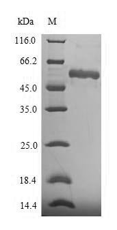 Human Asporin (ASPN) Recombinant Protein, Homo sapiens (Human), E.coli, N-terminal 6xHis-SUMO-tagged, 55.7 kDa, purity >≥ 90% as determined by SDS-PAGE.