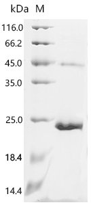 Human Agouti-signaling protein(ASIP) Recombinant Protein, Homo sapiens (Human), E.coli, C-terminal 6xHis-tagged, 19.1 kDa, purity >≥ 95% as determined by SDS-PAGE.