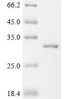 Human Ferritin heavy chain (FTH1) (H106A) Recombinant Protein - BioCrest Sci
