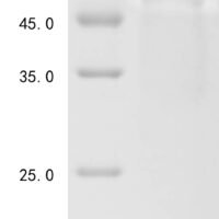 Human Follicle-stimulating hormone receptor (FSHR), partial Recombinant Protein, N-His-Trx - BioCrest Sci