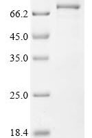 Human ATP-dependent RNA helicase DHX33 (DHX33) Recombinant Protein - BioCrest Sci