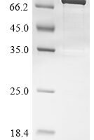 Human Poly [ADP-ribose] polymerase 2 (PARP2) Recombinant Protein, N-GST/C-His - BioCrest Sci