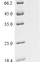 Human Mitofusin-2 (MFN2), partial Recombinant Protein - BioCrest Sci