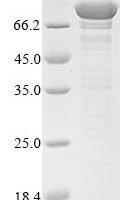 Human Vacuolar protein sorting-associated protein 35 (VPS35) Recombinant Protein, N-10His/C-Myc - BioCrest Sci