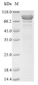 Human Vacuolar protein sorting-associated protein 35 (VPS35) Recombinant Protein, N-10His/C-Myc, Homo sapiens (Human), E.coli, N-terminal 10xHis-tagged and C-terminal Myc-tagged, 96.7 kDa, purity >≥ 85% as determined by SDS-PAGE.