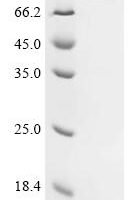 Human Trifunctional enzyme subunit alpha, mitochondrial (HADHA) Recombinant Protein - BioCrest Sci