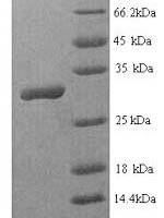 Human Homeobox protein Hox-B4 (HOXB4) Recombinant Protein - BioCrest Sci