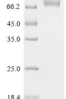 Human B-lymphocyte antigen CD19 (CD19), partial,Biotinylated Recombinant Protein - BioCrest Sci