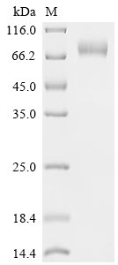 Human B-lymphocyte antigen CD19 (CD19), partial,Biotinylated Recombinant Protein, Homo sapiens (Human), Mammalian cell, C-terminal hFc1-Avi-tagged, 57.9 kDa, purity >≥ 95% as determined by SDS-PAGE.