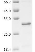 Human Neuron navigator 2 (NAV2), partial Recombinant Protein - BioCrest Sci