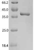 Pig Complement C3 (C3), partial Recombinant Protein, C-His, aa 1001–1302, E.coli - BioCrest Sci