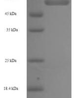 Human 2-oxoglutarate dehydrogenase, mitochondrial (OGDH) Recombinant Protein - BioCrest Sci