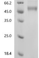 Mouse Killer cell lectin-like receptor subfamily G member 1 (Klrg1), partial, Biotinylated Recombinant Protein - BioCrest Sci