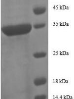 Human CCL5/RANTES Recombinant Protein, N-GST - BioCrest Sci