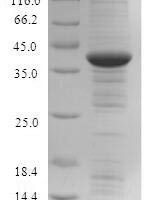 Human Indolethylamine N-methyltransferase (INMT) Recombinant Protein - BioCrest Sci