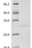 Rotavirus A Non-structural glycoprotein 4, partial Recombinant Protein, N-His-SUMOstar - BioCrest Sci