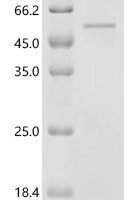 Human E3 ubiquitin-protein ligase TRAIP (TRAIP1) Recombinant Protein, N-10His/C-Myc - BioCrest Sci