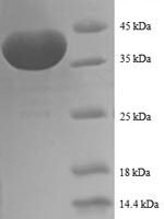 Human Prefoldin subunit 1 (PFDN1) Recombinant Protein - BioCrest Sci