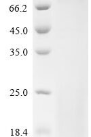 Mouse Inactive tyrosine-protein kinase 7 (Ptk7),partial Recombinant Protein - BioCrest Sci
