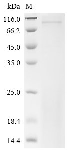 Mouse Inactive tyrosine-protein kinase 7 (Ptk7),partial Recombinant Protein, Mus musculus (Mouse), Yeast, C-terminal 6xHis-tagged, 76.1 kDa, purity >≥ 85% as determined by SDS-PAGE.