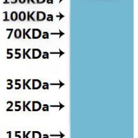 Human Platelet glycoprotein 4 (CD36)-VLPs, Fluorescent Recombinant Protein - BioCrest Sci