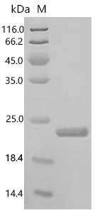 Staphylococcus aureus Immunodominant staphylococcal antigen B (isaB) Recombinant Protein, N-10His/C-Myc, aa 37–175, strain COL, Staphylococcus aureus (strain COL), E.coli, N-terminal 10xHis-tagged and C-terminal Myc-tagged, 20.8 kDa, purity >≥ 95% as determined by SDS-PAGE.