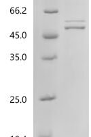 Human Nucleosome assembly protein 1-like 1 (NAP1L1) Recombinant Protein, C-His, aa 2–388, Yeast - BioCrest Sci