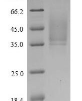 Human Probetacellulin (BTC) Recombinant Protein - BioCrest Sci