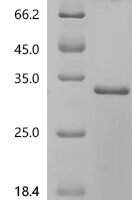 Human Bcl-2-like protein 1(BCL2L1), partial Recombinant Protein - BioCrest Sci
