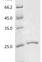 Human Interleukin-2 (IL2) Recombinant Protein, C-10His - BioCrest Sci