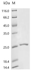 Human Interleukin-2 (IL2) Recombinant Protein, C-10His, Homo sapiens (Human), E.coli, C-terminal 10xHis-tagged, 22.9 kDa, purity >≥ 90% as determined by SDS-PAGE.