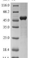 Rickettsia conorii Outer membrane protein A (ompA), partial Recombinant Protein, N-10His-SUMO/C-Myc - BioCrest Sci