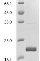 Human Seizure protein 6 homolog (SEZ6), partial Recombinant Protein, C-10His, aa 528–591, E.coli - BioCrest Sci