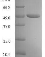 Human Paraneoplastic antigen Ma2 (PNMA2), partial Recombinant Protein, N-His, aa 2–261, E.coli - BioCrest Sci